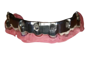 implant3